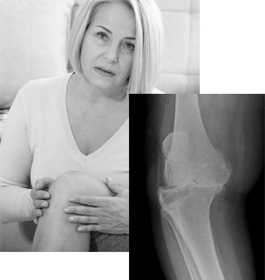 Rose und ihr Knie vorher