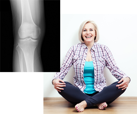 Rose und ihr Knie nachher